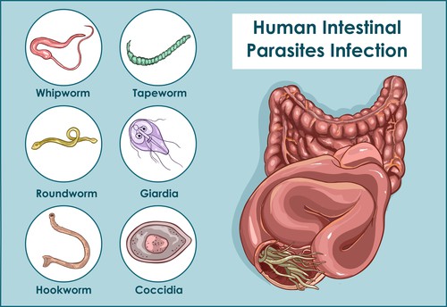 Stomach Parasites Symptoms [and how to get rid of them] - Quit Chronic ...