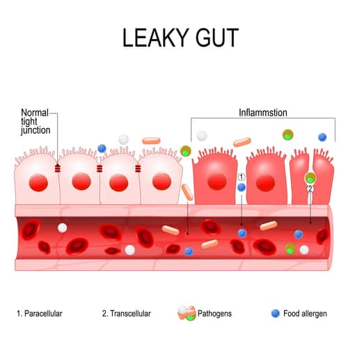 signs leaky gut healing is needed