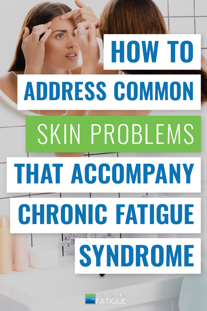 How To Address Common Skin Problems That Accompany Chronic Fatigue Syndrome | Quit Chronic Fatigue