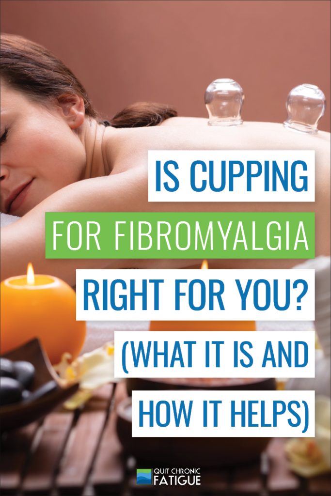 Is Cupping for Fibromyalgia Right For You? What It Is & How It Helps | Quit Chronic Fatigue 